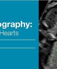 Fetal Echocardiography Normal and Abnormal Hearts 2018 (Videos)