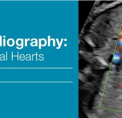 Fetal Echocardiography Normal and Abnormal Hearts 2018 (Videos)