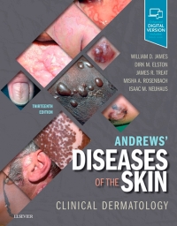 Andrews' Diseases of the Skin Clinical Dermatology, 13e (True PDF)