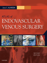 Atlas of Endovascular Venous Surgery, 2e (True PDF)