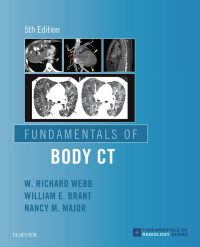 Fundamentals of Body CT, 5e (True PDF)