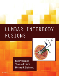 Lumbar Interbody Fusions, 1e (True PDF)