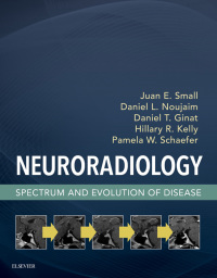 Neuroradiology Spectrum and Evolution of Disease, 1e (True PDF)
