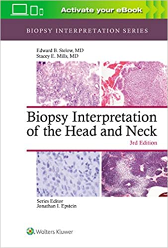 Biopsy Interpretation of the Head and Neck (EPUB)