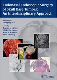 Endonasal Endoscopic Surgery of Skull Base Tumors: An Interdisciplinary Approach (True PDF)